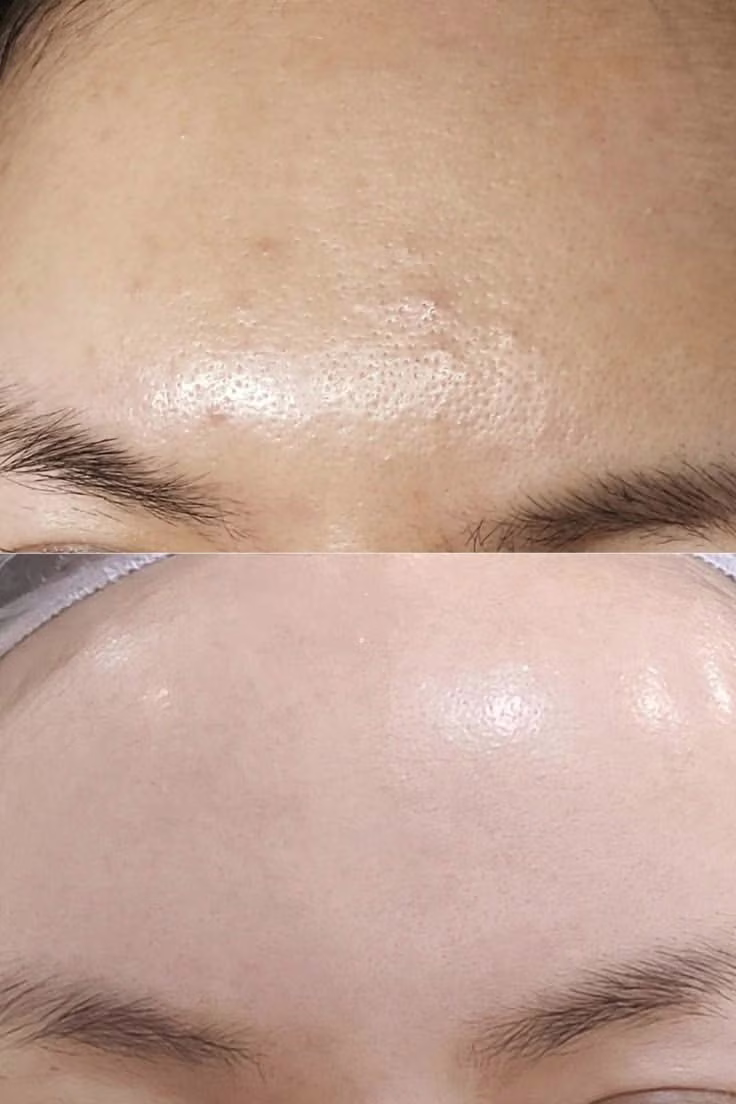 Skincare before after